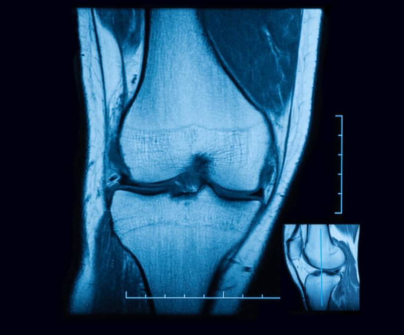 Game day: One very common use for MRI is sports injuries. It's often the best choice for getting images of soft tissue damage in joints, ligaments and muscles.