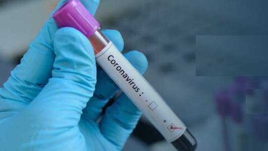 Health authorities say there's been a strong turnout for coronavirus testing.